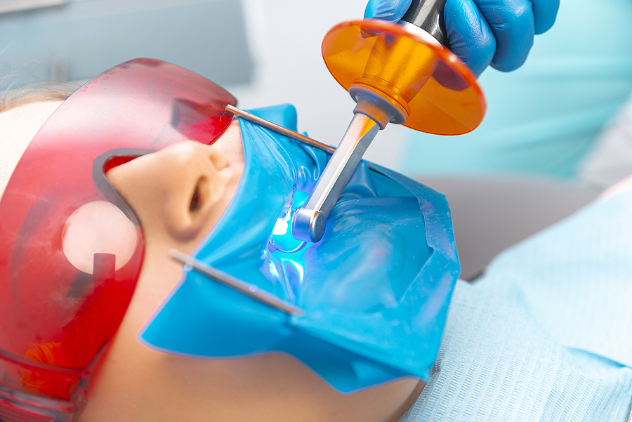 Laser Dentistry: A Modern Approach to Cavities and Oral Wellness